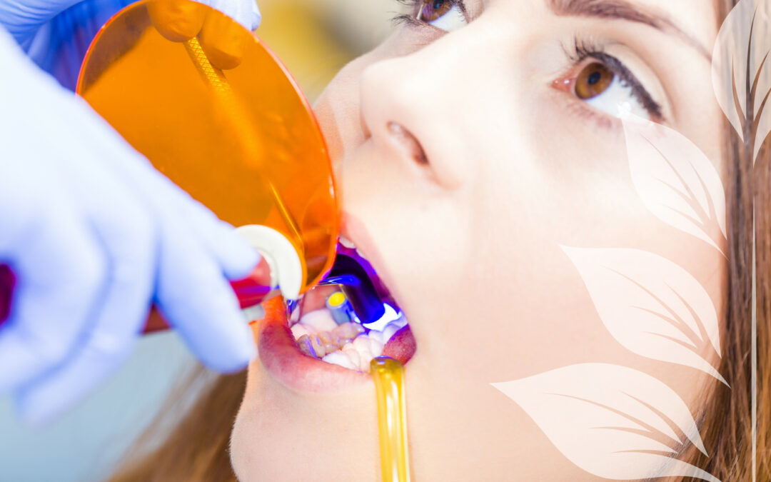 Dental Bonding vs. Veneers: Choosing the Right Cosmetic Solution