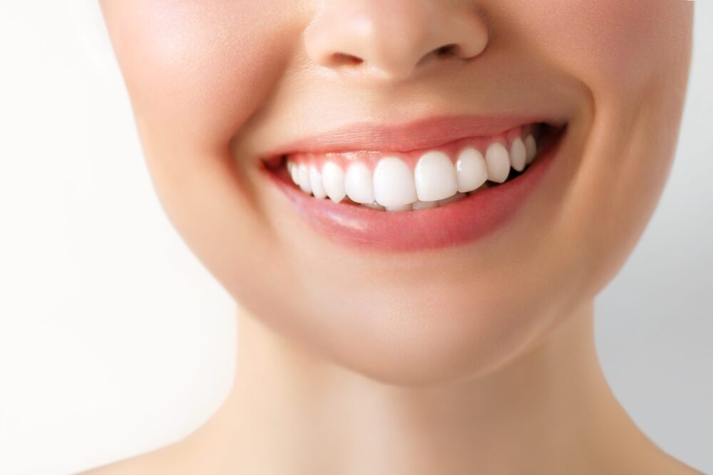 teeth whitening Griffin